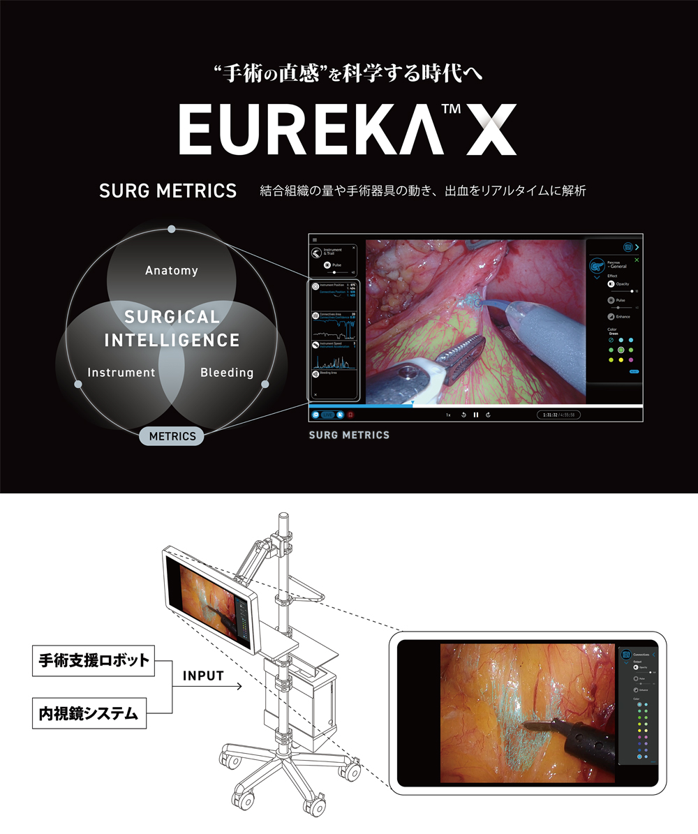 外科手術AIシステム「EUREKA」の写真